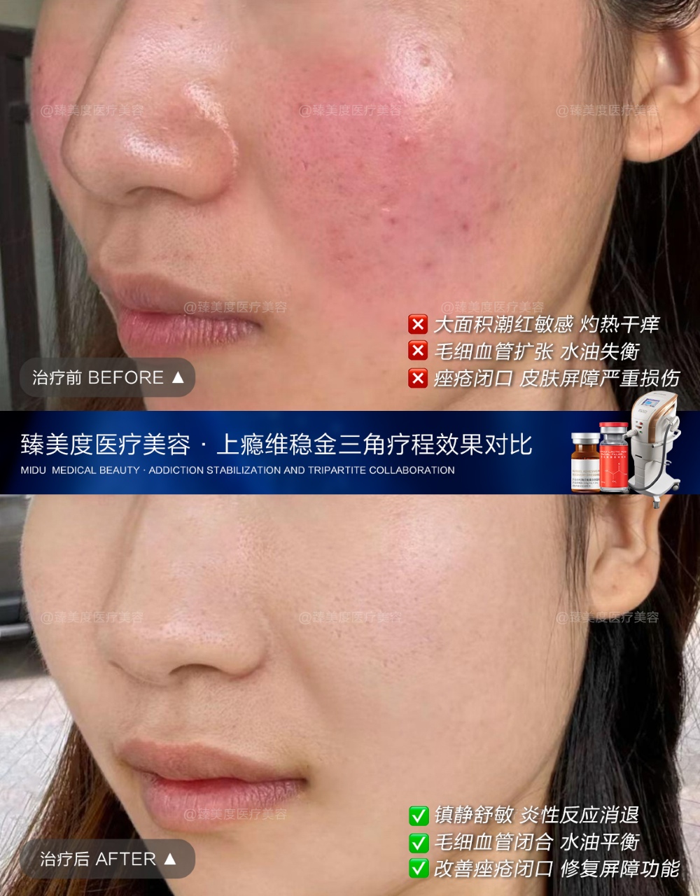 shenzhen-endolift-lift